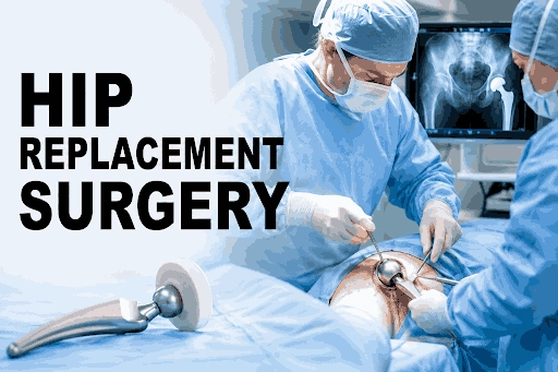 Common Signs You May Need Hip Replacement Surgery